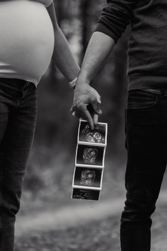 Babybauchshooting_Ybbs_an_der_Donau_Carografie_Caroline_Nagl-3823 Love - Babybauchshooting - Ultraschallbild in Schwarz-Weiss