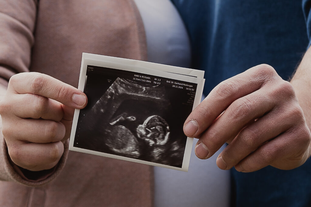 Babybauchshooting_Ybbs_an_der_Donau_Carografie_Caroline_Nagl-3963 Ultraschallbild in Händen